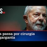 Lesão na garganta obriga Lula a passar por cirurgia em SP
